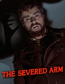 The Severed Arm