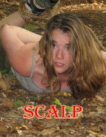 Scalp