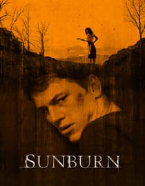 Sunburn