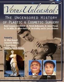 Venus Unleashed: The Uncensored History of Plastic and Cosmetic Surgery