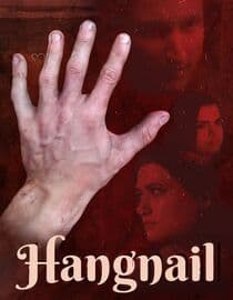 Hangnail