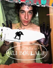 The Scars of Ali Boulala