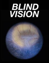 Blind Vision