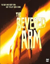 The Severed Arm
