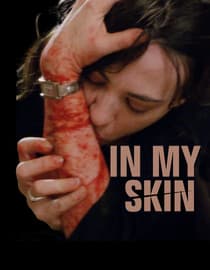 In My Skin